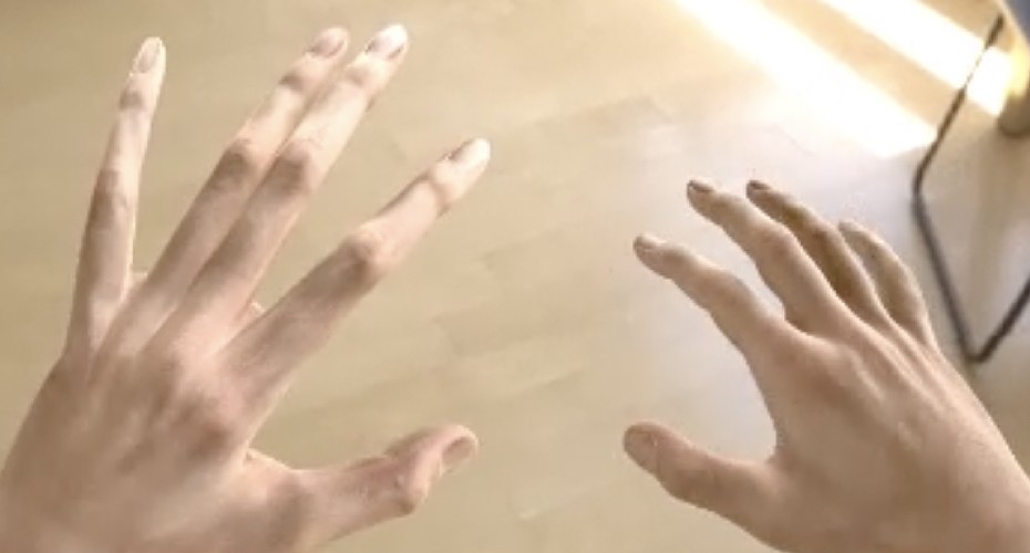 A mock image of what a crps patient might see, with elongated fingers on the left hand.